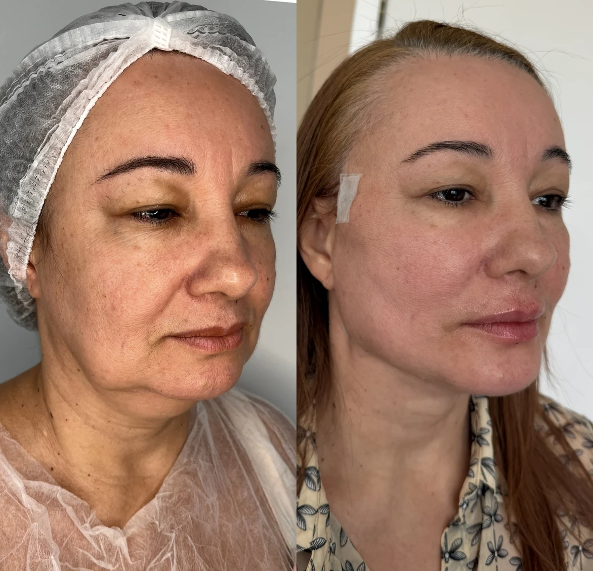 Full Face